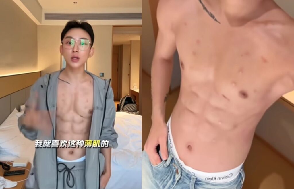 中國網紅砸1745萬打造「人工八塊腹肌」　整形醫警告恐導致可怕下場
